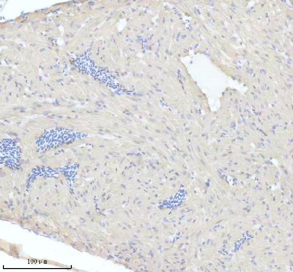 IHC analysis of MYL7 using anti-MYL7 antibody (AZQ801M3)