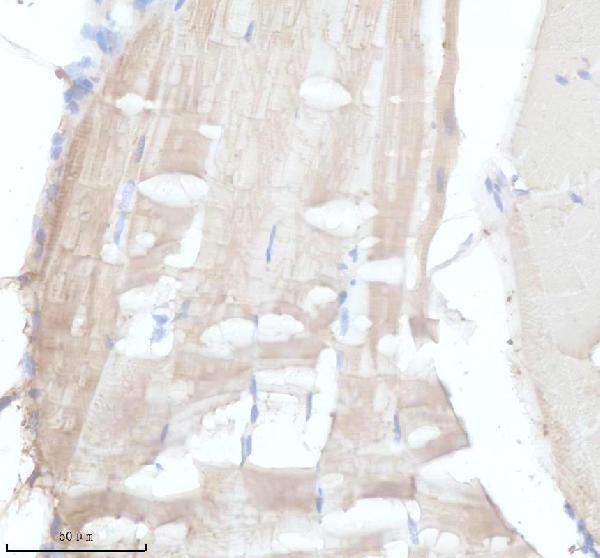 IHC analysis of MYL7 using anti-MYL7 antibody (AZQ801M3)