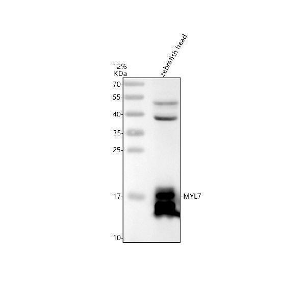 Western blot analysis of MYL7 using anti-MYL7 antibody (AZQ801M3)