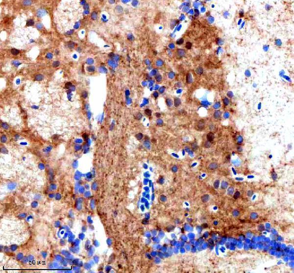 azq801u3 srsf3a b primary antibodies ihc testing 1