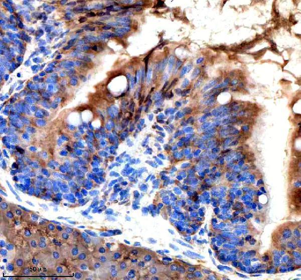 azq801u3 srsf3a b primary antibodies ihc testing 2