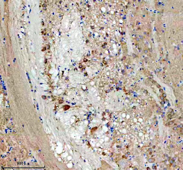 azq802c9 eif4a1a b 2 primary antibodies ihc testing 2
