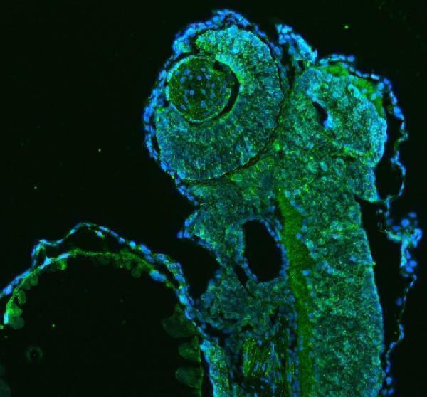  IF analysis of HSP60/HSPD1 using anti-HSP60/HSPD1 antibody (AZQ803B0)