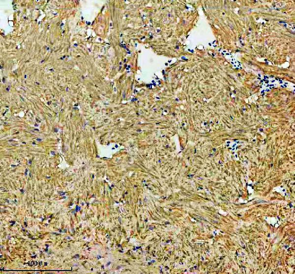  IHC analysis of HSP60/HSPD1 using anti-HSP60/HSPD1 antibody (AZQ803B0)