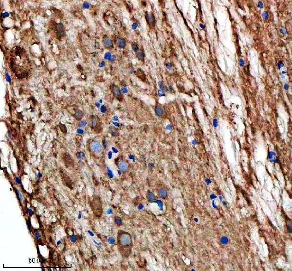 azq803b0 hspd1 primary antibodies ihc testing 5