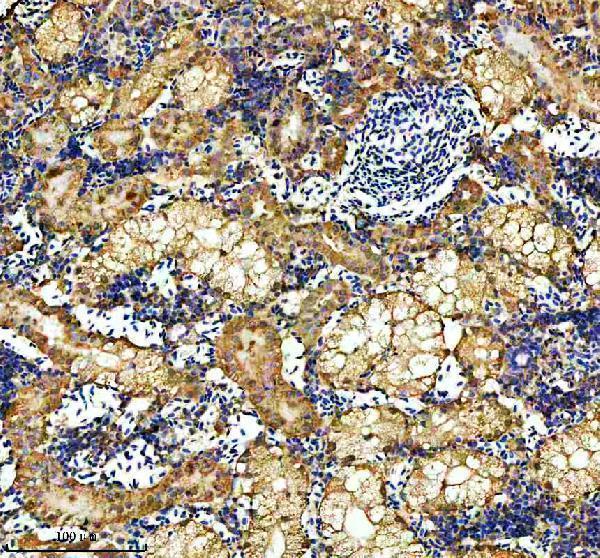 azq803b0 hspd1 primary antibodies ihc testing 6