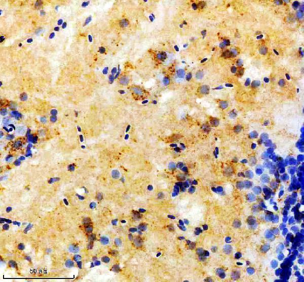 IHC analysis of DCP2 using anti-DCP2 antibody (AZQ803B9)