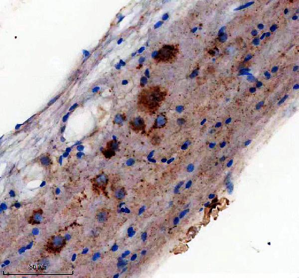 IHC analysis of DCP2 using anti-DCP2 antibody (AZQ803B9)