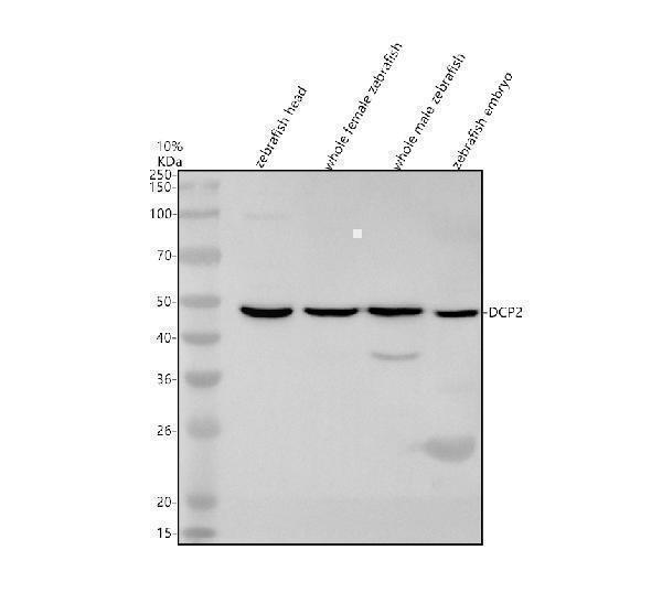 Western blot analysis of DCP2 using anti-DCP2 antibody (AZQ803B9)