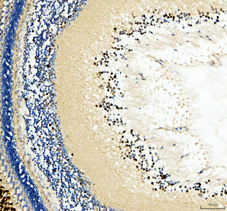 IHC analysis of HNRNPC using anti-HNRNPC antibody (AZQ803J4)