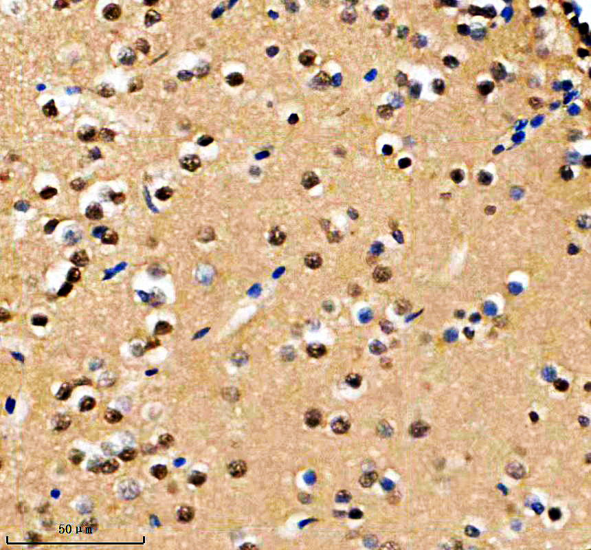 IHC analysis of HNRNPC using anti-HNRNPC antibody (AZQ803J4)