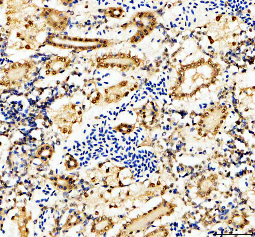 azq803j4 hnrnpc primary antibodies ihc testing 3