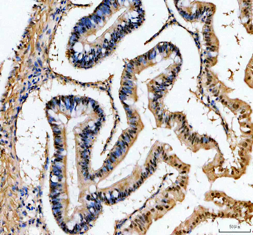 azq803j4 hnrnpc primary antibodies ihc testing 5