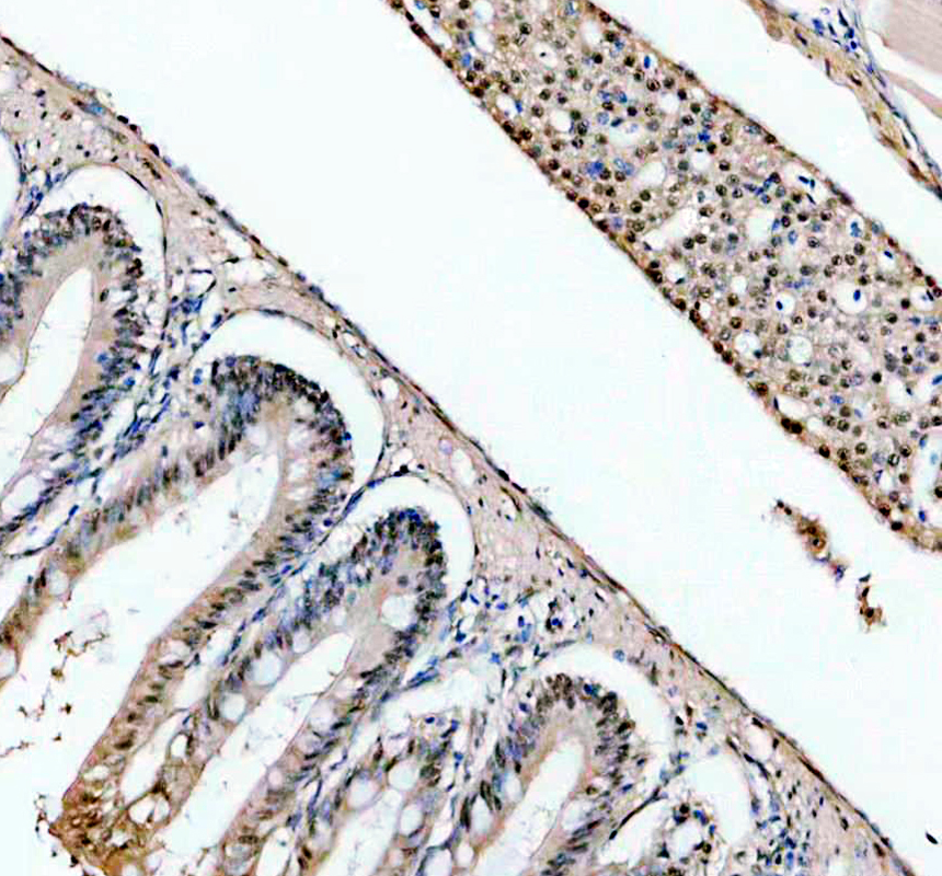 azq803j4 hnrnpc primary antibodies ihc testing 6