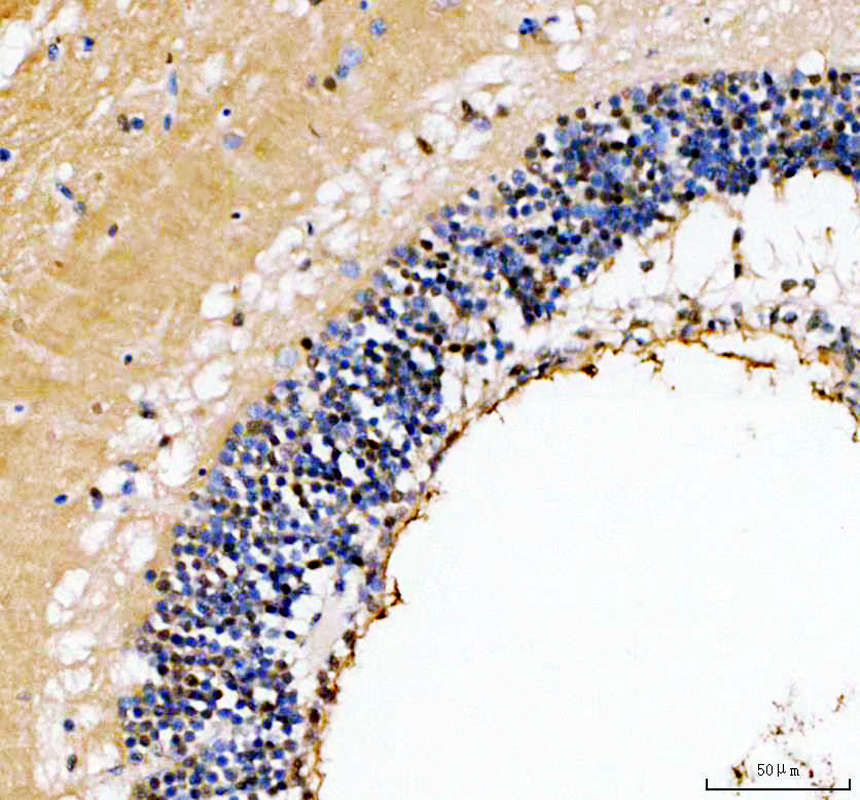 azq803j4 hnrnpc primary antibodies ihc testing 7