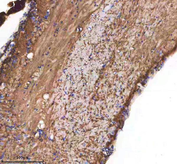 azq8av10 cxcl12a b primary antibodies ihc testing 1