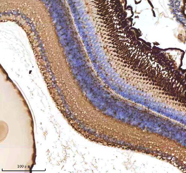  IHC analysis of ATOH7 using anti-ATOH7 antibody (AZQ8AW52)