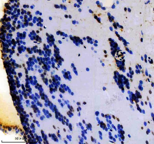 azq8awz2 hoxa3a primary antibodies ihc testing 1