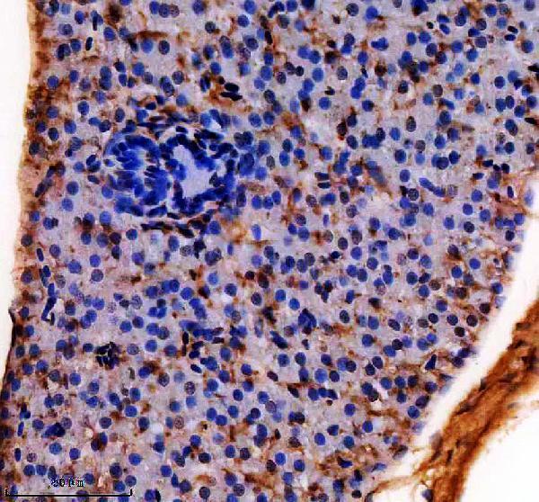 azq8awz2 hoxa3a primary antibodies ihc testing 2