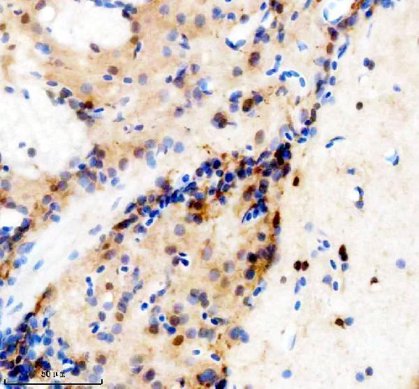 IHC analysis of TBX1 using anti-TBX1 antibody (AZQ8AXX2)