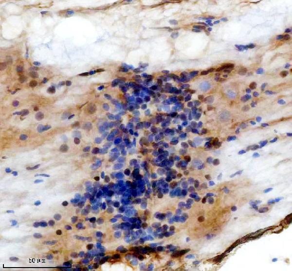IHC analysis of TBX1 using anti-TBX1 antibody (AZQ8AXX2)