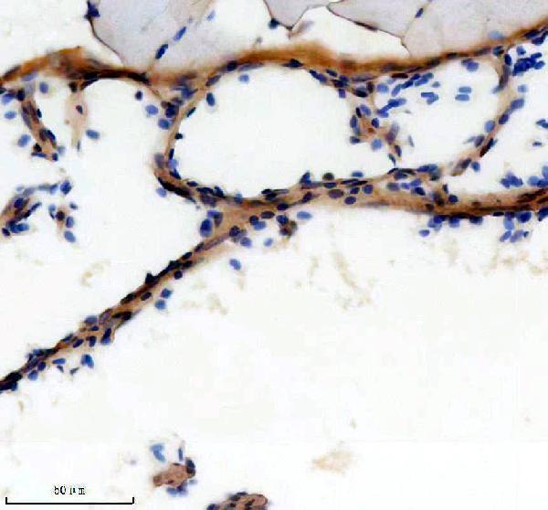IHC analysis of TBX1 using anti-TBX1 antibody (AZQ8AXX2)