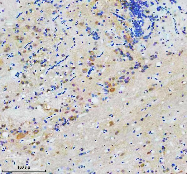  IHC analysis of CCT7 using anti-CCT7 antibody (AZQ8JHG7)