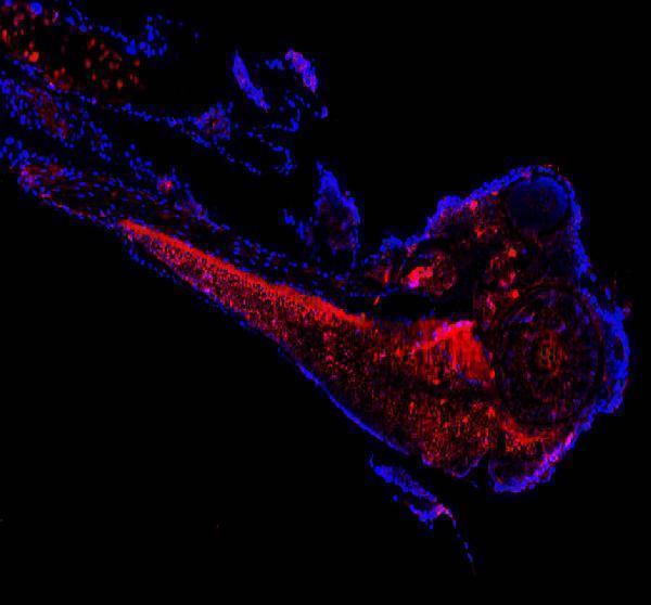  IF analysis of CCT3 using anti-CCT3 antibody (AZQ8JHI7)