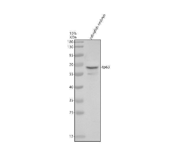 Western blot analysis of p63/TP63 using anti-p63/TP63 antibody (AZQ8JHZ6)