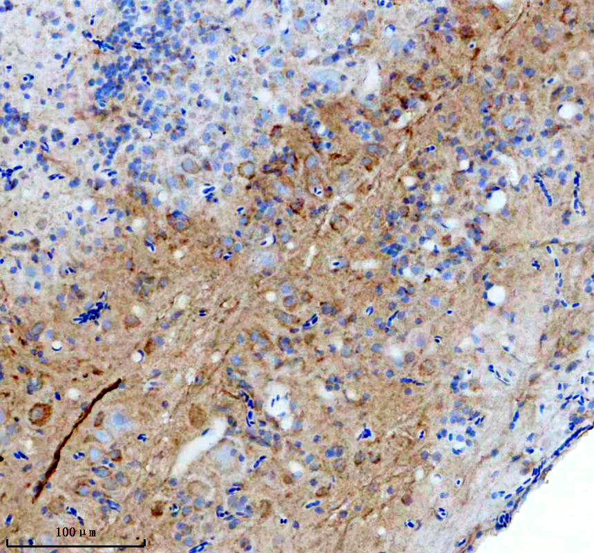azq8qgu1 gbx2 primary antibodies ihc testing 1