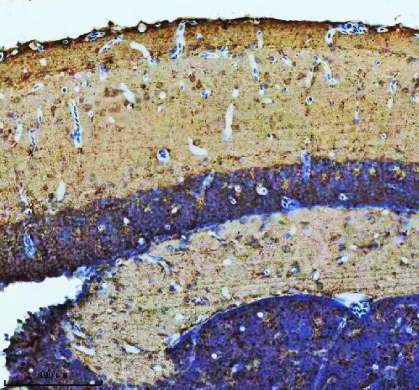  IHC analysis of ATP6V1B2 using anti-ATP6V1B2 antibody (AZQ8QHA6)