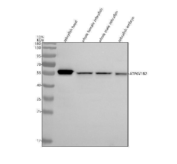  Western blot analysis of ATP6V1B2 using anti-ATP6V1B2 antibody (AZQ8QHA6)