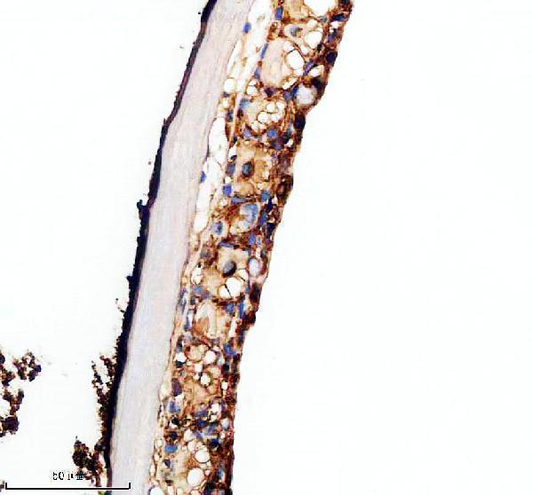 IHC analysis of VANGL2 using anti-VANGL2 antibody (AZQ8UVJ6)