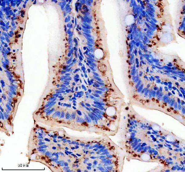IHC analysis of VANGL2 using anti-VANGL2 antibody (AZQ8UVJ6)