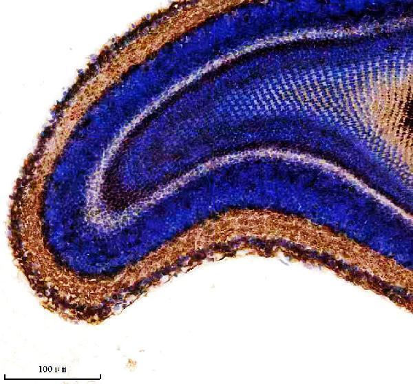 IHC analysis of PIWIL1 using anti-PIWIL1 antibody (AZQ8UVX0)