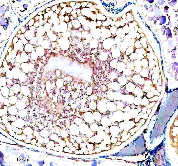 IHC analysis of PIWIL1 using anti-PIWIL1 antibody (AZQ8UVX0)