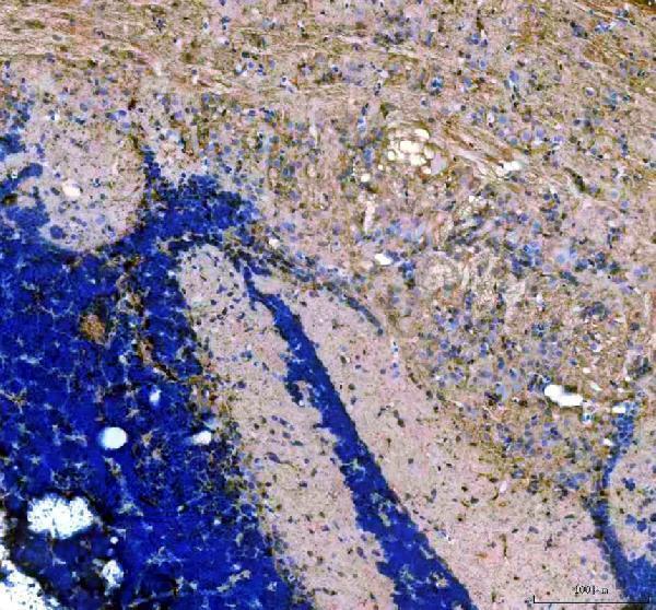 azq8uvx0 piwil1 primary antibodies ihc testing 3