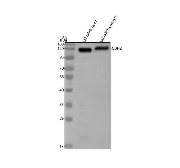  Western blot analysis of N-Cadherin/CDH2 using anti-N-Cadherin/CDH2 antibody (AZQ90275)