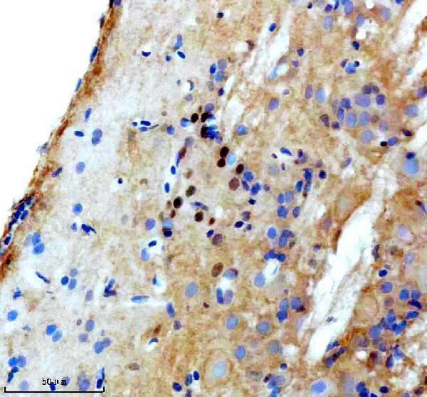 azq90421 lhx3 primary antibodies ihc testing 1