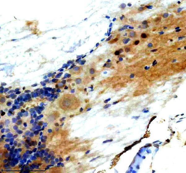 azq90421 lhx3 primary antibodies ihc testing 2