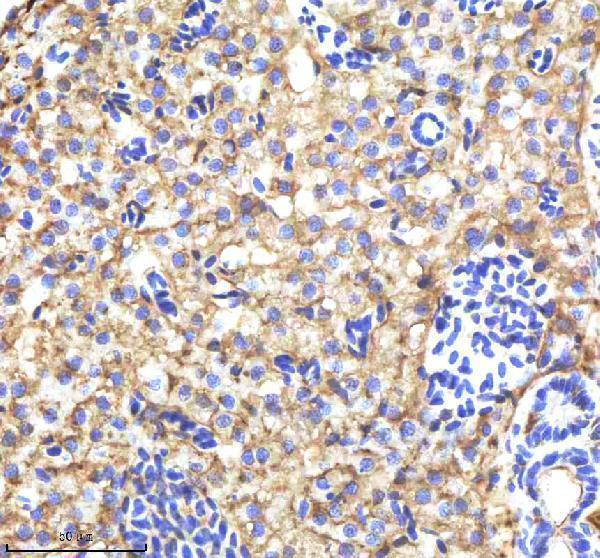 azq90460 alcama primary antibodies ihc testing 4