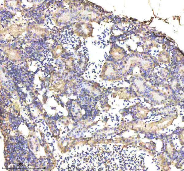 azq90460 alcama primary antibodies ihc testing 7