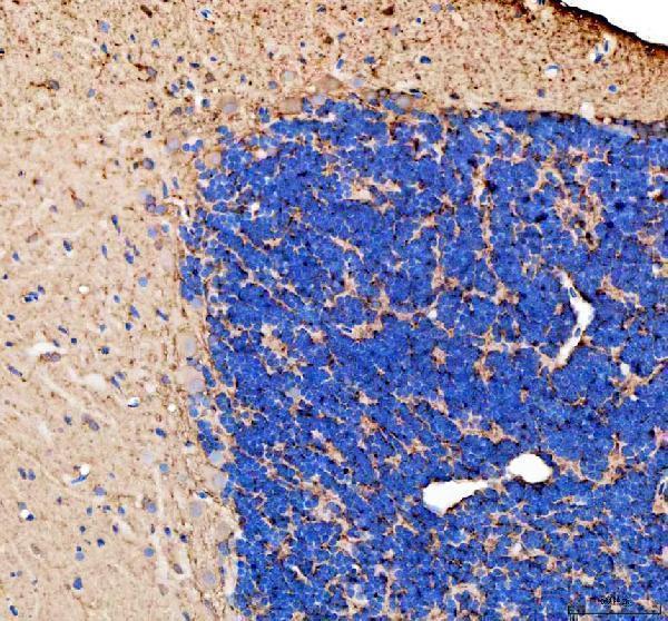  IHC analysis of GAP43 using anti-GAP43 antibody (AZQ90462)
