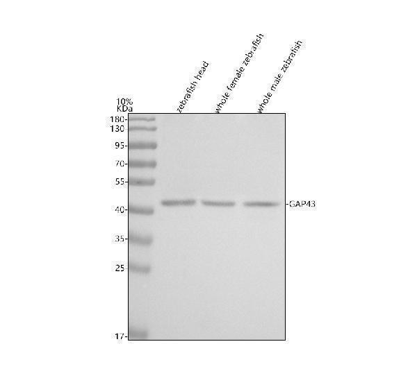  Western blot analysis of GAP43 using anti-GAP43 antibody (AZQ90462)