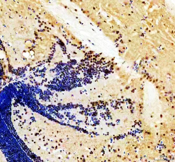 azq90466 her4 1 2 3 5 primary antibodies ihc testing 1