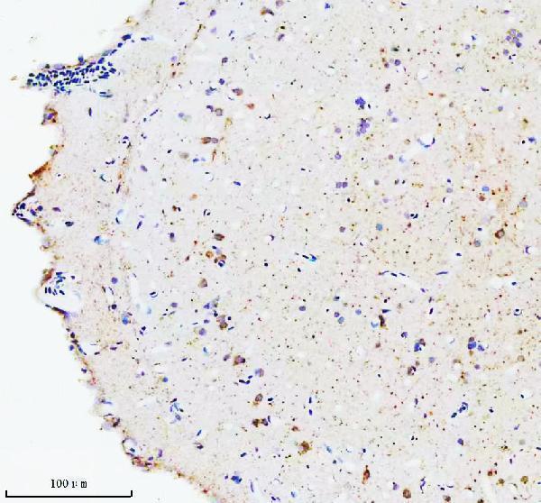  IHC analysis of HSC70/HSPA8 using anti-HSC70/HSPA8 antibody (AZQ90473)
