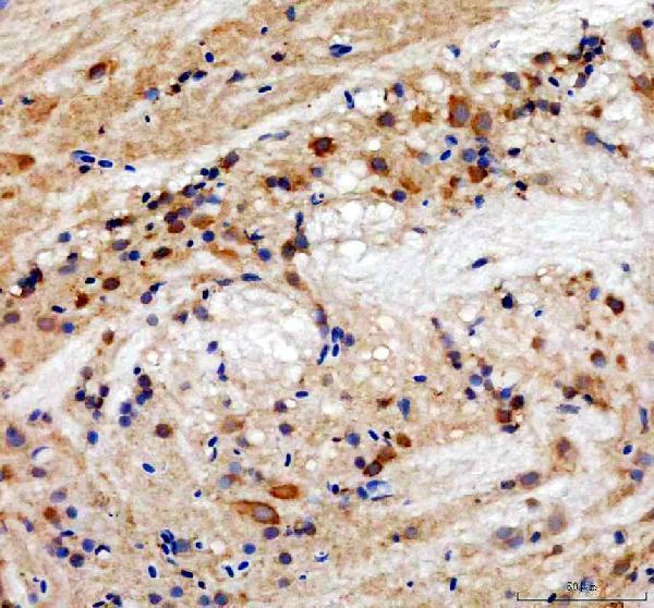 azq90474 hsp90a primary antibodies ihc testing 2