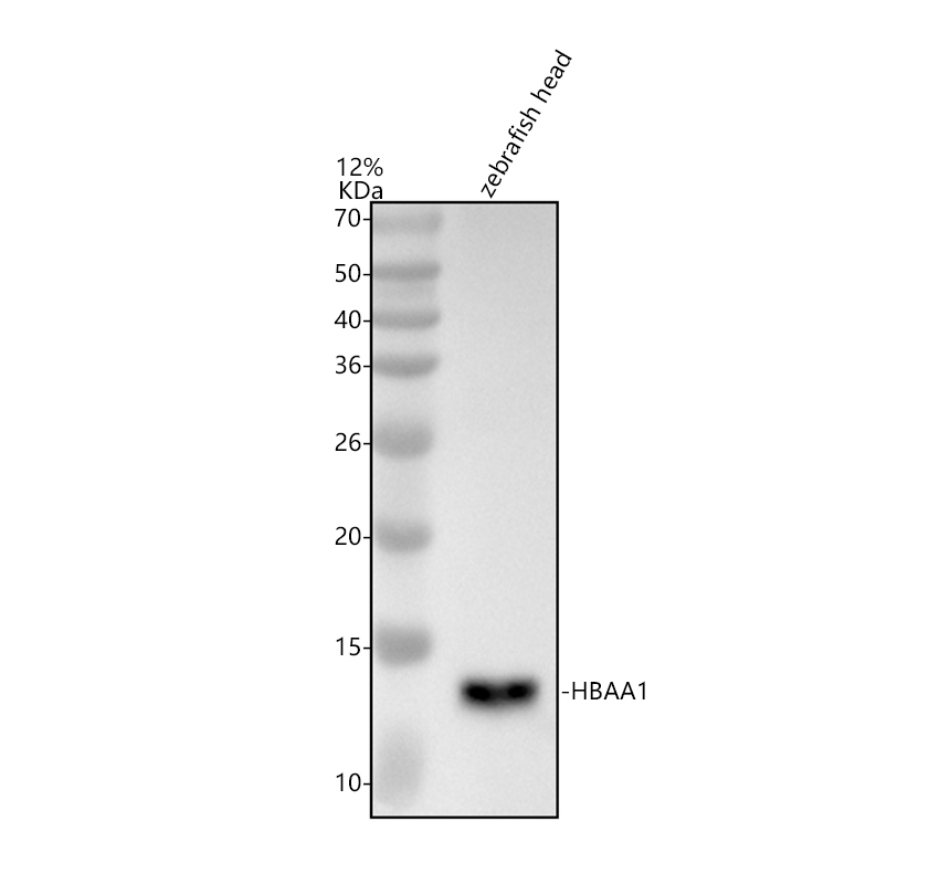 Western blot analysis of HBAA1 using anti-HBAA1 antibody (AZQ90487)