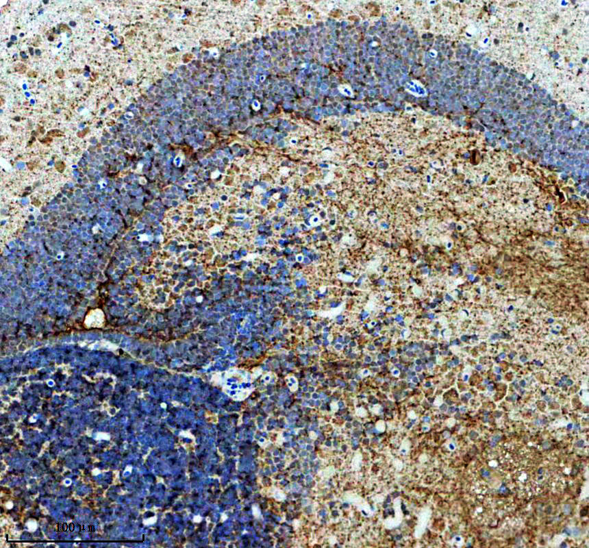 azq90491 tcf3a primary antibodies ihc testing 1