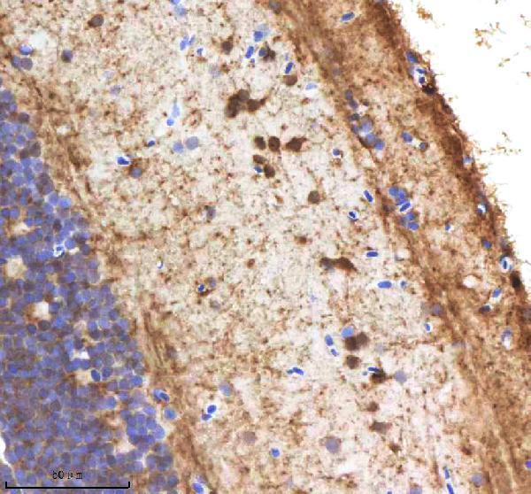 IHC analysis of NANOS3 using anti-NANOS3 antibody (AZQ90WW1)
